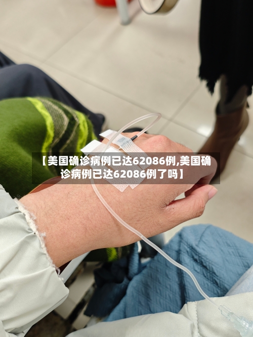 【美国确诊病例已达62086例,美国确诊病例已达62086例了吗】-第2张图片